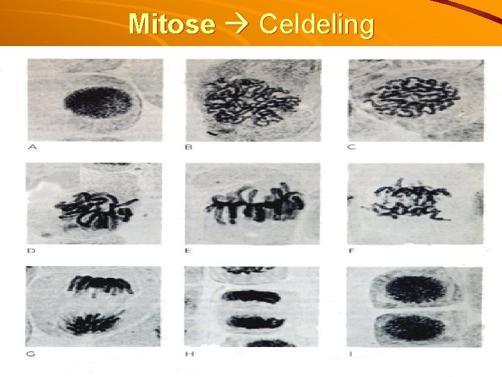Mitose Celdeling 