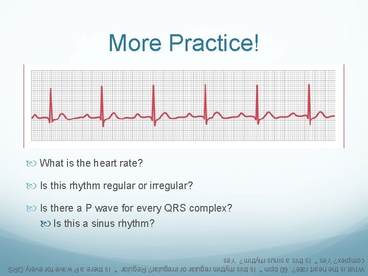 What is the heart rate? 60 bpm * Is this rhythm regular or irregular?