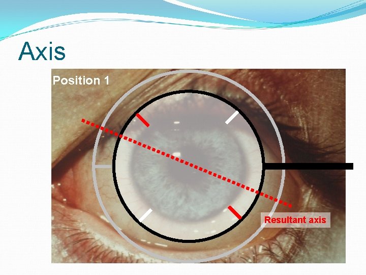 Axis Position 1 Resultant axis 