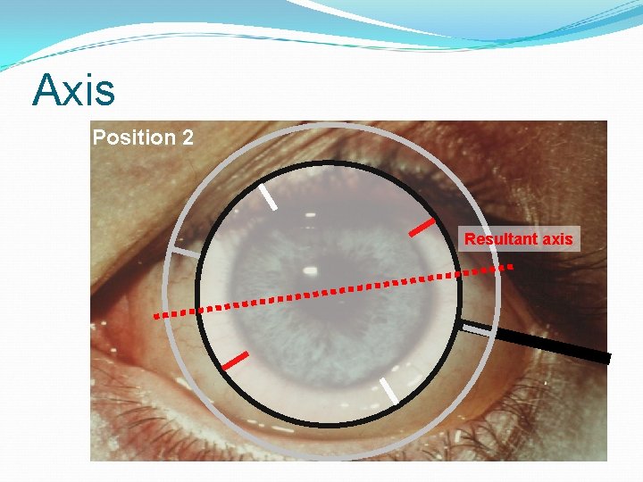 Axis Position 2 Resultant axis 