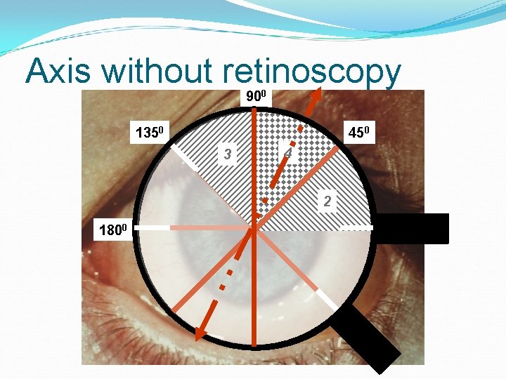 Axis without retinoscopy 900 450 1350 3 4 2 1800 00 