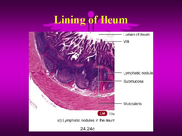 Lining of Ileum 