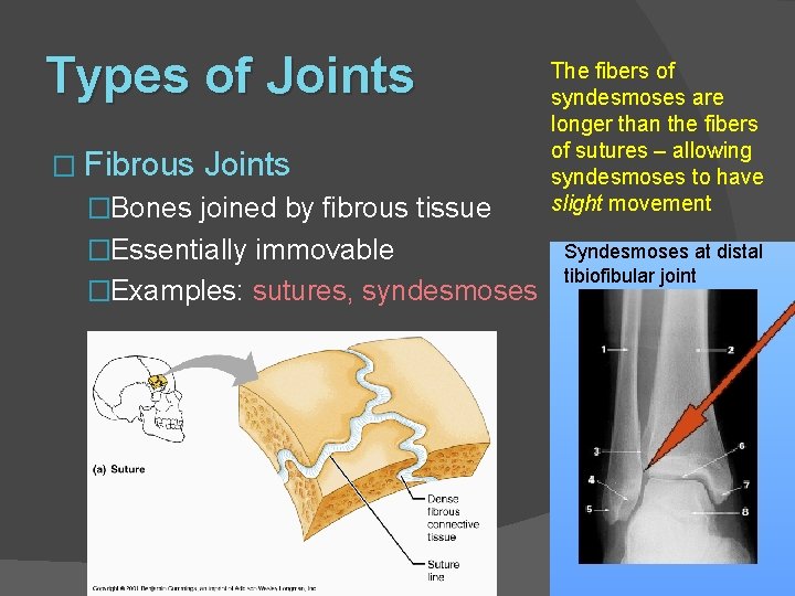 Types of Joints � Fibrous Joints �Bones joined by fibrous tissue �Essentially immovable �Examples: