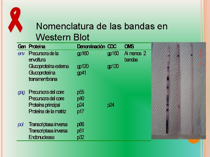  Nomenclatura de las bandas en Western Blot Por: Lic. Ricardo Saldaña 5 