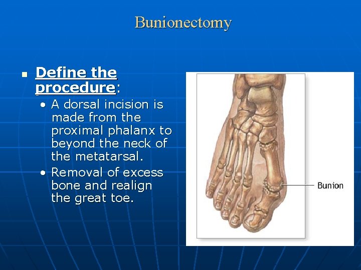 Bunionectomy n Define the procedure: • A dorsal incision is made from the proximal