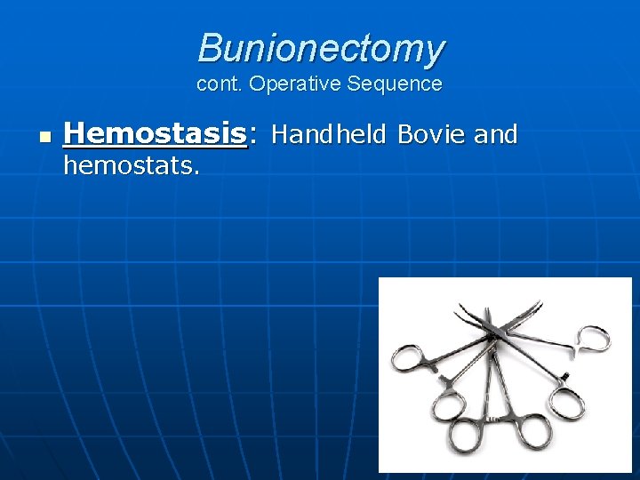 Bunionectomy cont. Operative Sequence n Hemostasis: Handheld Bovie and hemostats. 