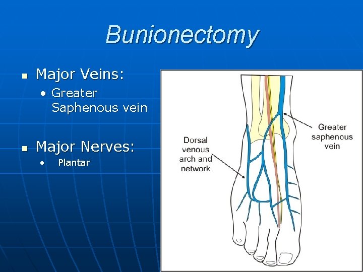 Bunionectomy n Major Veins: • Greater Saphenous vein n Major Nerves: • Plantar 
