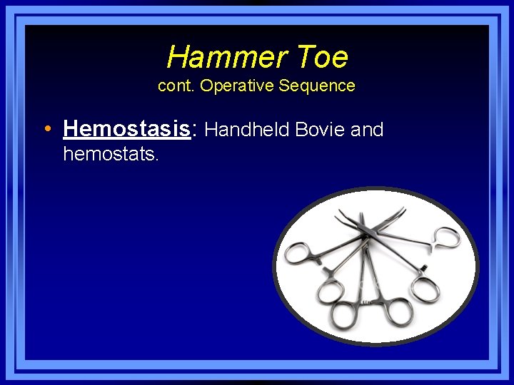 Hammer Toe cont. Operative Sequence • Hemostasis: Handheld Bovie and hemostats. 