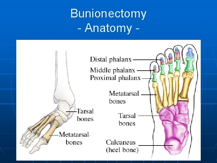 Bunionectomy - Anatomy - 