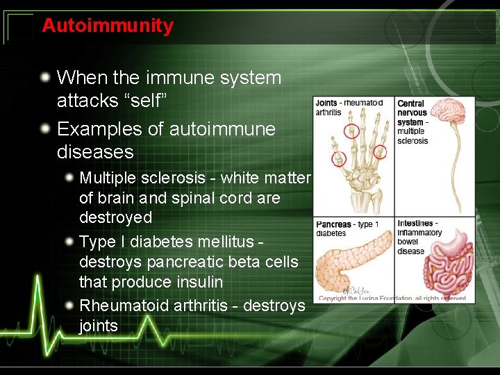 Autoimmunity When the immune system attacks “self” Examples of autoimmune diseases Multiple sclerosis -