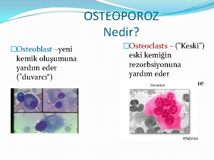 OSTEOPOROZ Nedir? �Osteoblast –yeni kemik oluşumuna yardım eder ("duvarcı“) �Osteoclasts – ("Keski") eski kemiğin