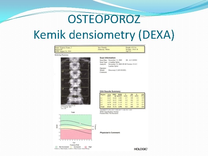 OSTEOPOROZ Kemik densiometry (DEXA) 