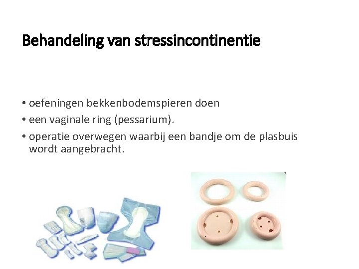 Behandeling van stressincontinentie • oefeningen bekkenbodemspieren doen • een vaginale ring (pessarium). • operatie