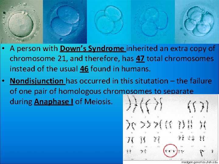  • A person with Down’s Syndrome inherited an extra copy of chromosome 21,