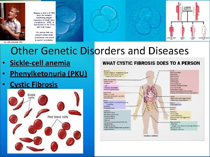 Other Genetic Disorders and Diseases • Sickle-cell anemia • Phenylketonuria (PKU) • Cystic Fibrosis