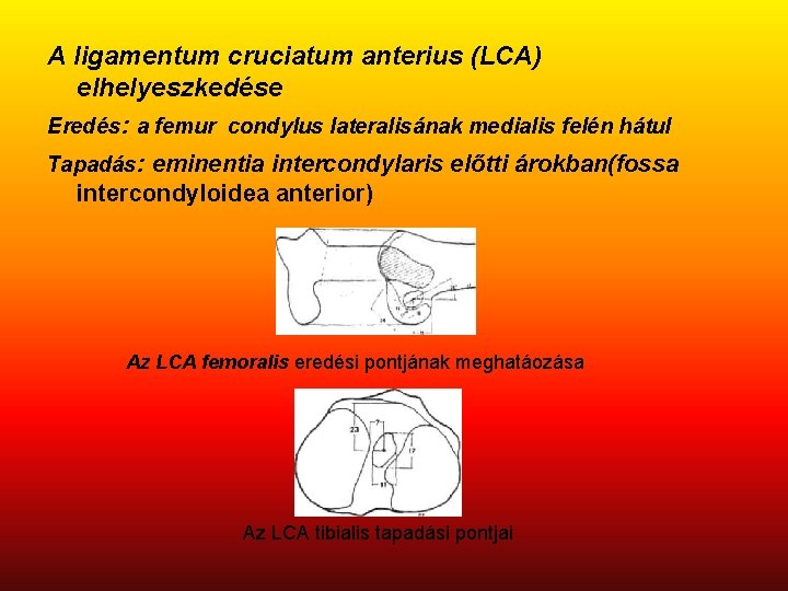 A ligamentum cruciatum anterius (LCA) elhelyeszkedése Eredés: a femur condylus lateralisának medialis felén hátul