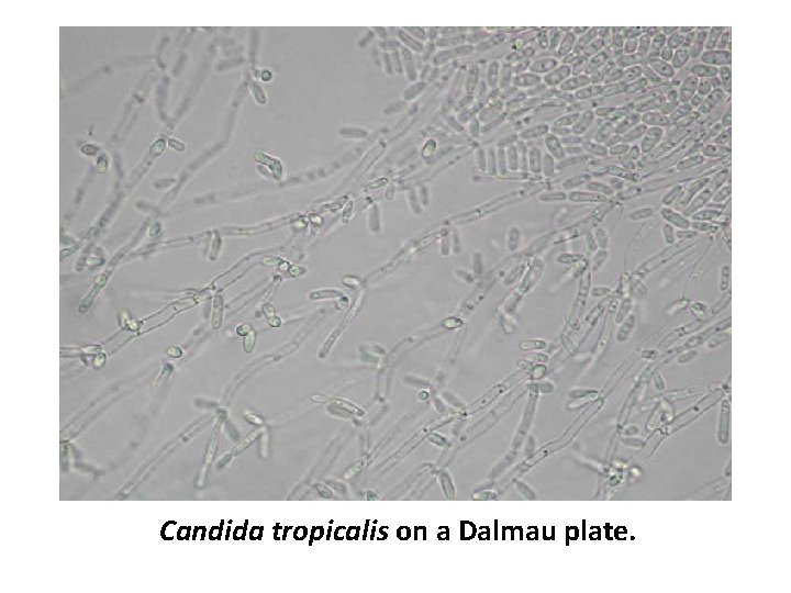 Candida tropicalis on a Dalmau plate. 