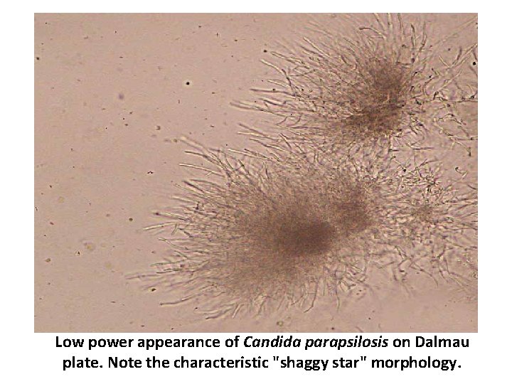 Low power appearance of Candida parapsilosis on Dalmau plate. Note the characteristic "shaggy star"