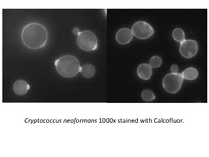 Cryptococcus neoformans 1000 x stained with Calcofluor. 
