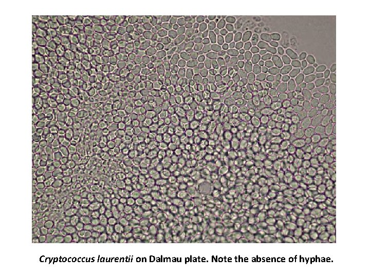 Cryptococcus laurentii on Dalmau plate. Note the absence of hyphae. 