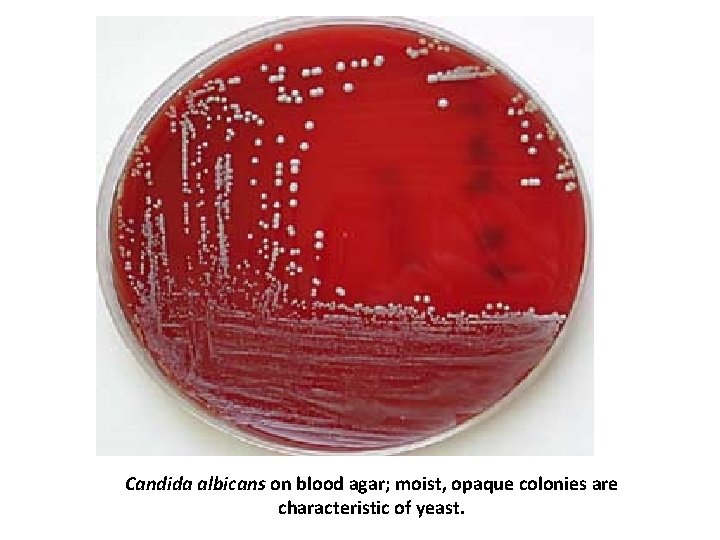 Candida albicans on blood agar; moist, opaque colonies are characteristic of yeast. 