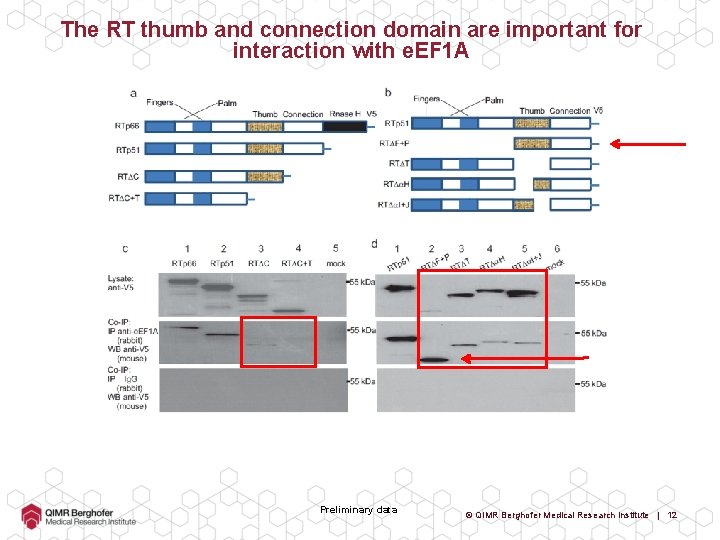The RT thumb and connection domain are important for interaction with e. EF 1