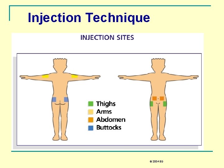 Injection Technique © 2004 BD 