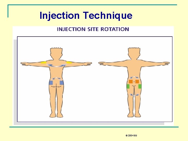 Injection Technique © 2004 BD 