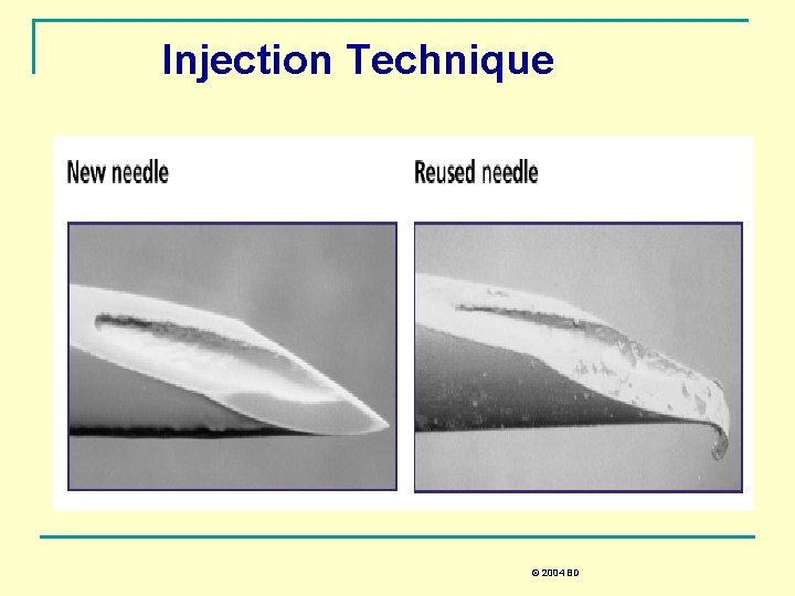 Injection Technique © 2004 BD 