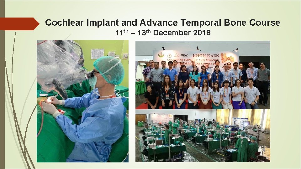 Cochlear Implant and Advance Temporal Bone Course 11 th – 13 th December 2018