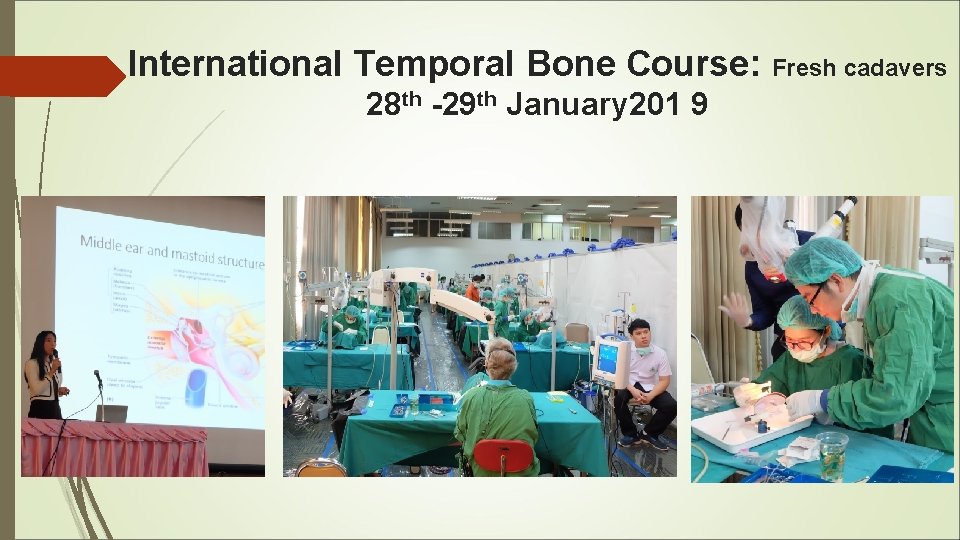 International Temporal Bone Course: Fresh cadavers 28 th -29 th January 201 9 