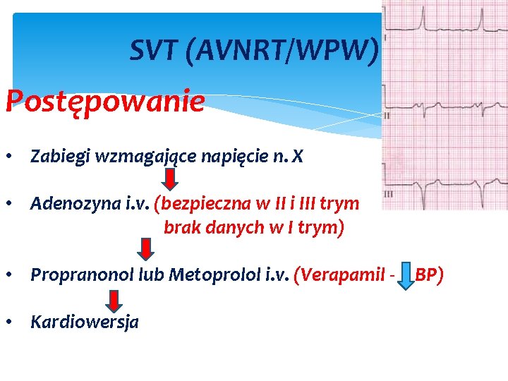 SVT (AVNRT/WPW) Postępowanie • Zabiegi wzmagające napięcie n. X • Adenozyna i. v. (bezpieczna