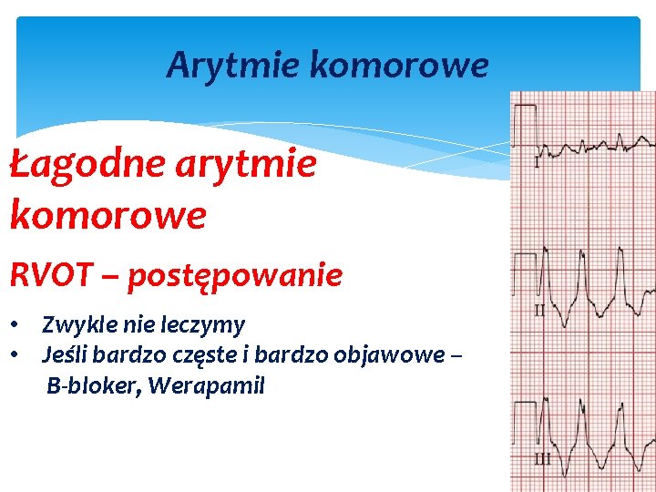 Arytmie komorowe Łagodne arytmie komorowe RVOT – postępowanie • Zwykle nie leczymy • Jeśli