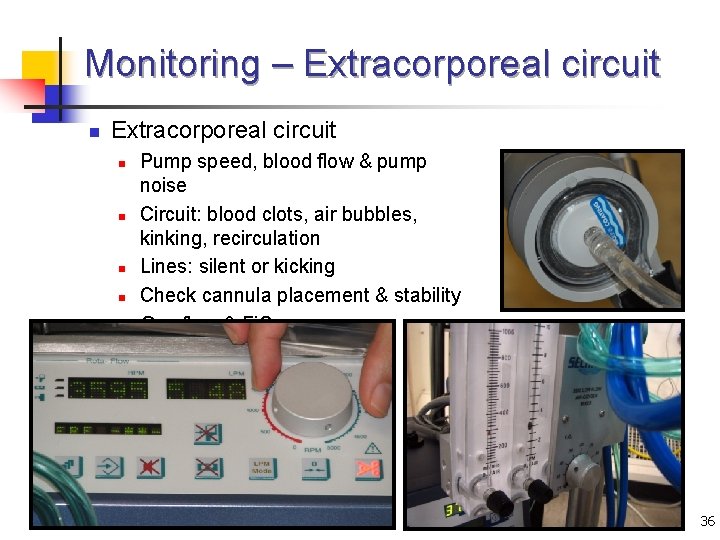 Monitoring – Extracorporeal circuit n n n Pump speed, blood flow & pump noise