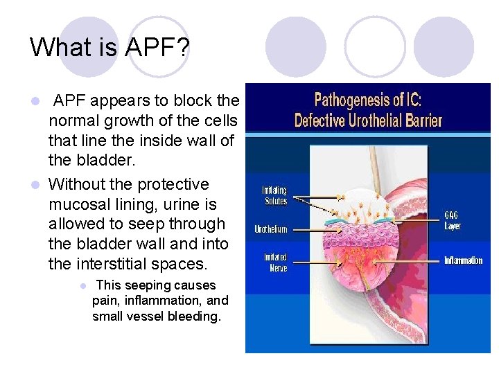 What is APF? APF appears to block the normal growth of the cells that