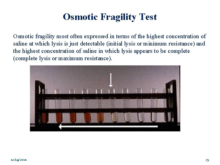 Osmotic Fragility Test Osmotic fragility most often expressed in terms of the highest concentration