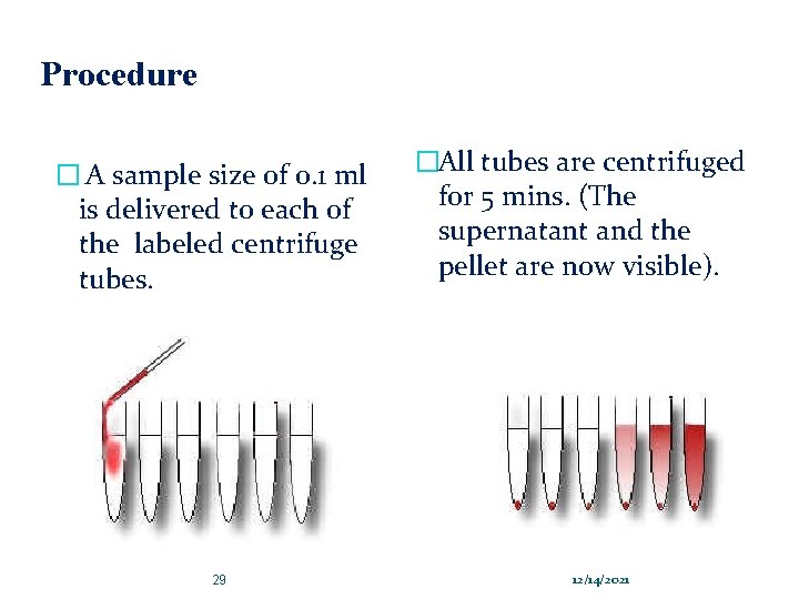 Procedure � A sample size of 0. 1 ml is delivered to each of