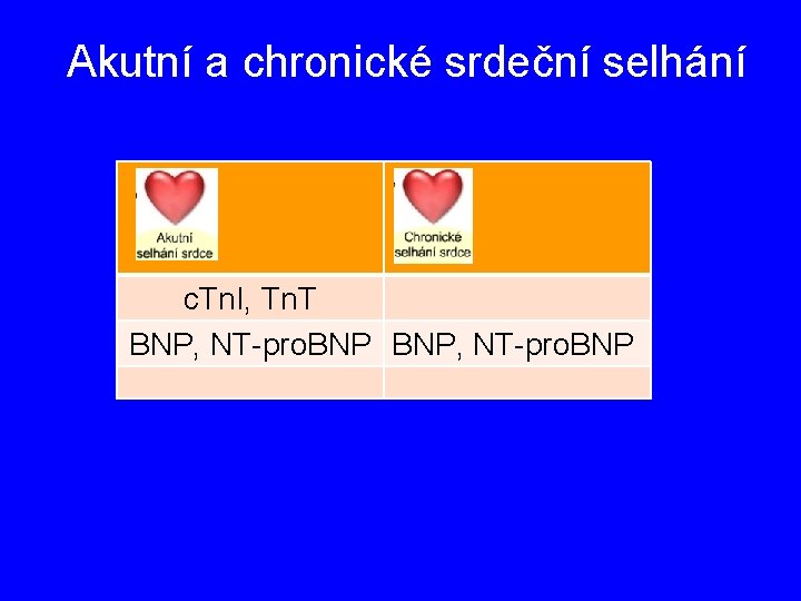 Akutní a chronické srdeční selhání c. Tn. I, Tn. T BNP, NT-pro. BNP 