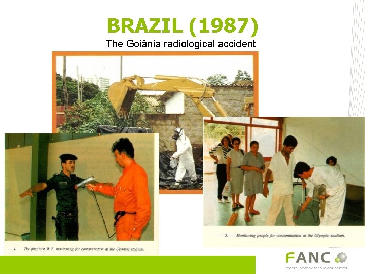 BRAZIL (1987) The Goiânia radiological accident 