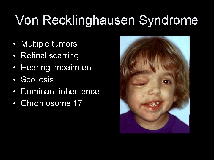 Von Recklinghausen Syndrome • • • Multiple tumors Retinal scarring Hearing impairment Scoliosis Dominant