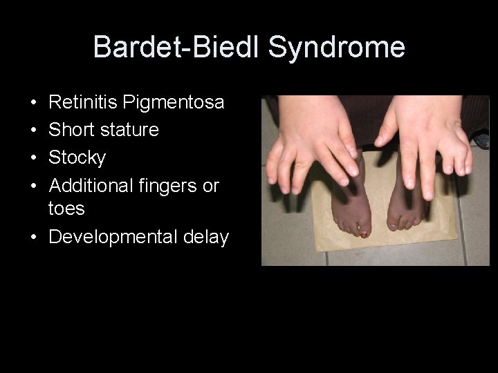 Bardet-Biedl Syndrome • • Retinitis Pigmentosa Short stature Stocky Additional fingers or toes •