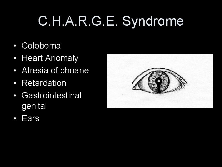 C. H. A. R. G. E. Syndrome • • • Coloboma Heart Anomaly Atresia