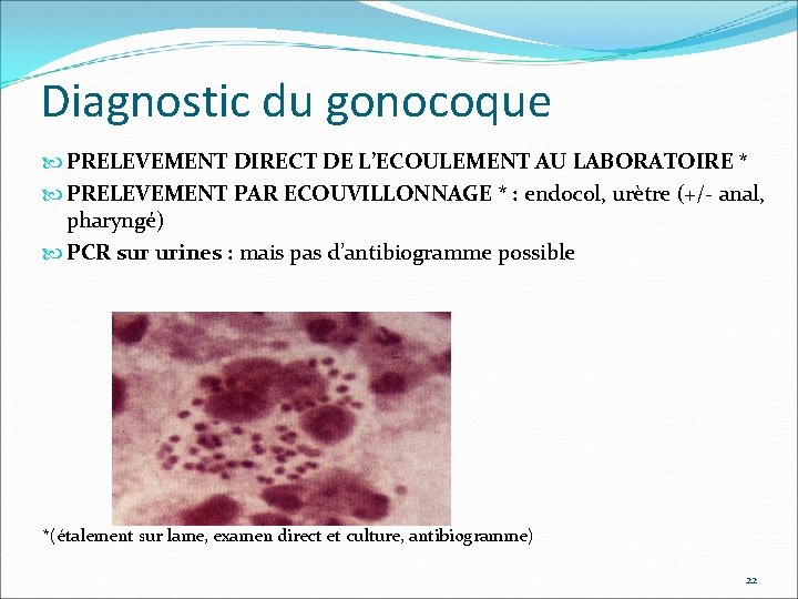 Diagnostic du gonocoque PRELEVEMENT DIRECT DE L’ECOULEMENT AU LABORATOIRE * PRELEVEMENT PAR ECOUVILLONNAGE *