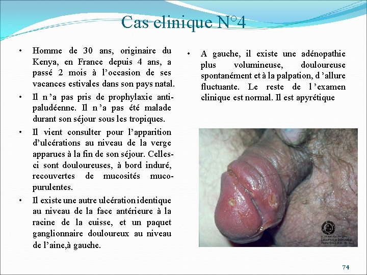 Cas clinique N° 4 • • Homme de 30 ans, originaire du Kenya, en