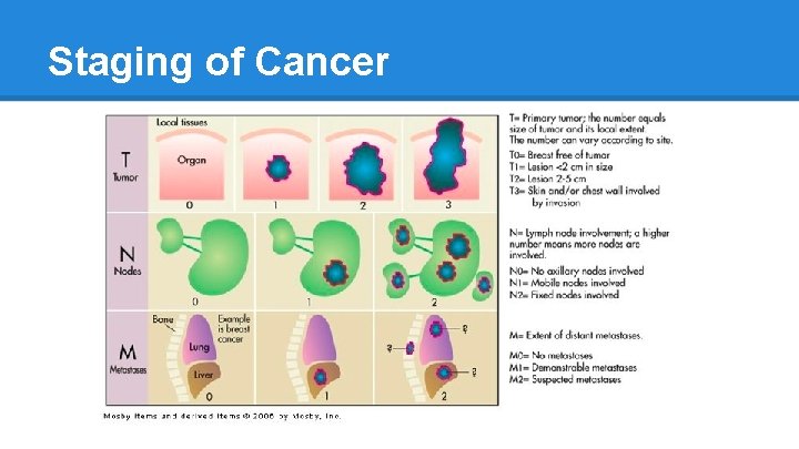 Staging of Cancer 