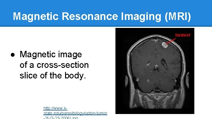 Magnetic Resonance Imaging (MRI) ● Magnetic image of a cross-section slice of the body.