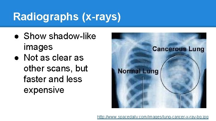 Radiographs (x-rays) ● Show shadow-like images ● Not as clear as other scans, but