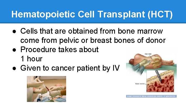 Hematopoietic Cell Transplant (HCT) ● Cells that are obtained from bone marrow come from