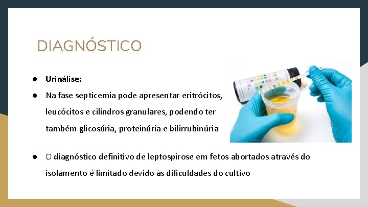 DIAGNÓSTICO ● Urinálise: ● Na fase septicemia pode apresentar eritrócitos, leucócitos e cilindros granulares,