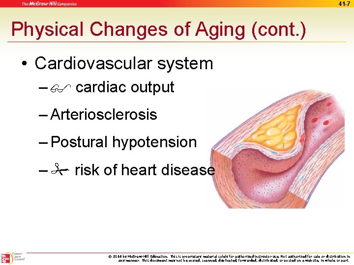 41 -7 Physical Changes of Aging (cont. ) • Cardiovascular system – cardiac output